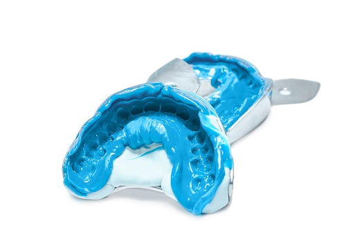 印象採得へのこだわり