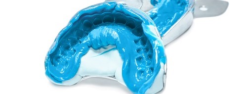 印象採得へのこだわり